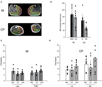 Quantitative MRI and Clinical Assessment of Muscle Function in Adults With Cerebral Palsy